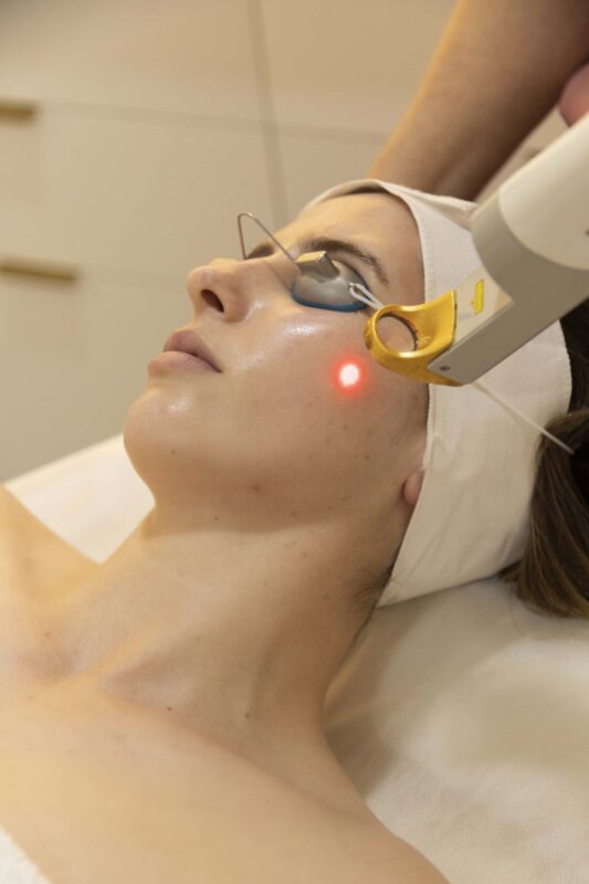 In2skin Merimbula | laser treatment | cosmedical| beauty
